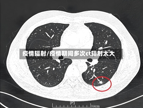 疫情辐射/疫情期间多次ct辐射太大-第3张图片