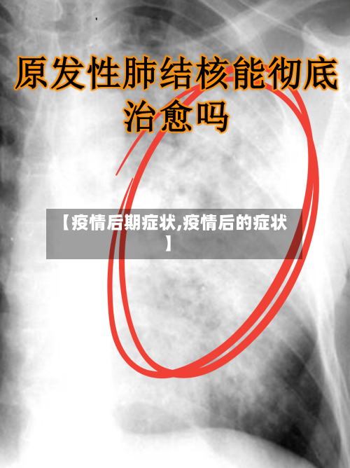 【疫情后期症状,疫情后的症状】