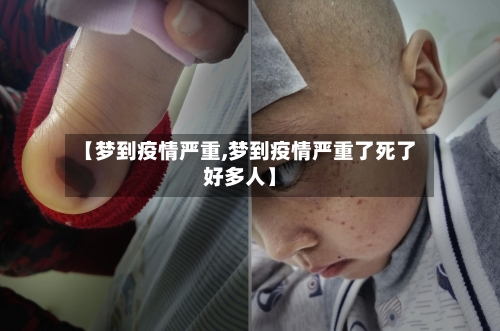 【梦到疫情严重,梦到疫情严重了死了好多人】