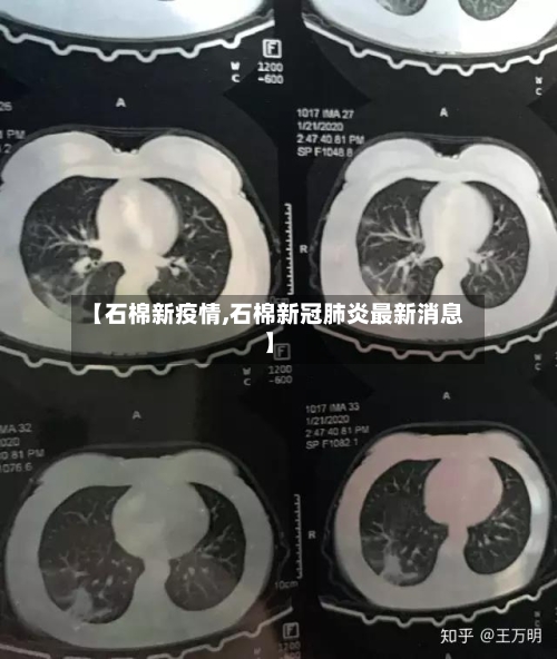 【石棉新疫情,石棉新冠肺炎最新消息】