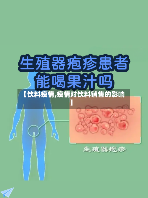 【饮料疫情,疫情对饮料销售的影响】-第3张图片