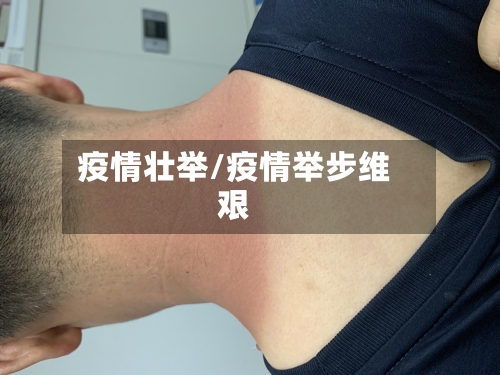 疫情壮举/疫情举步维艰