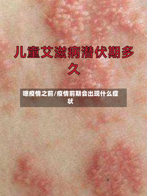 嗯疫情之前/疫情前期会出现什么症状