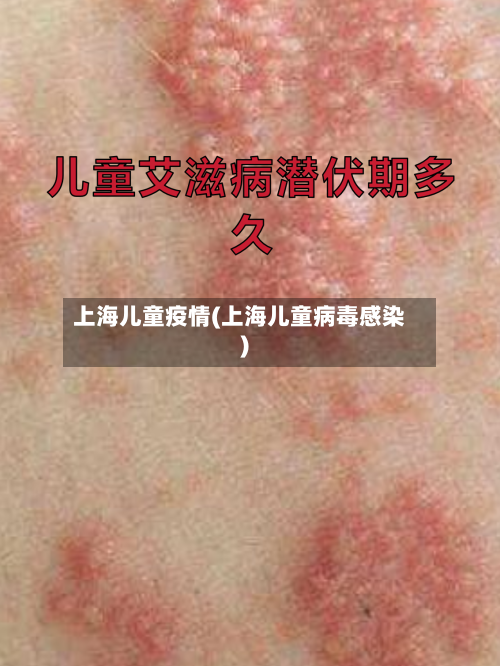 上海儿童疫情(上海儿童病毒感染)