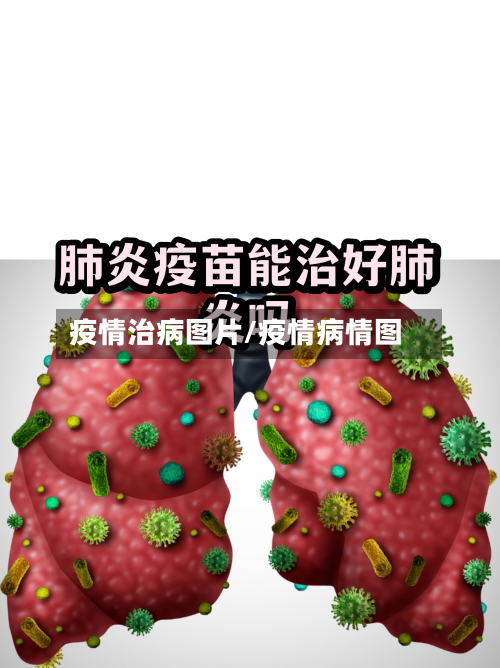 疫情治病图片/疫情病情图