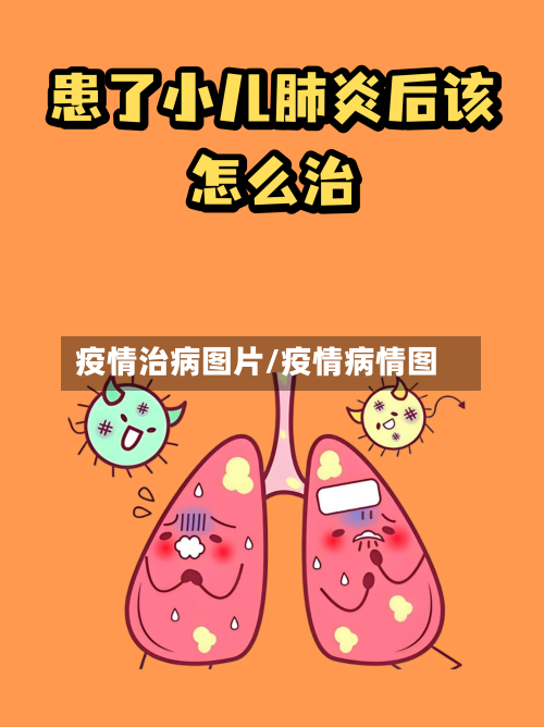 疫情治病图片/疫情病情图-第2张图片